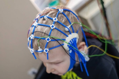 New Drug Shows Promise for Children with Rare Epilepsy